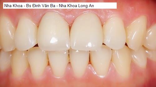 Hình ảnh Nha Khoa - Bs Đinh Văn Ba - Nha Khoa Long An