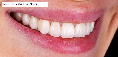 Hình ảnh Nha Khoa Võ Đức Nhuận