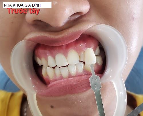 Hình ảnh NHA KHOA GIA ĐÌNH