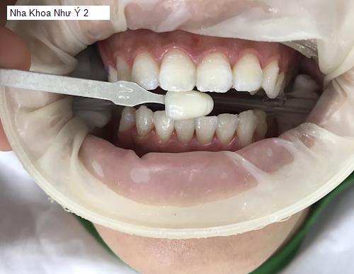 Hình ảnh Nha Khoa Như Ý 2