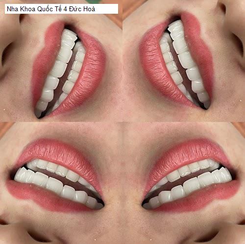 Hình ảnh Nha Khoa Quốc Tế 4 Đức Hoà