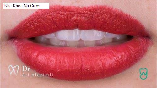 Hình ảnh Nha Khoa Nụ Cười