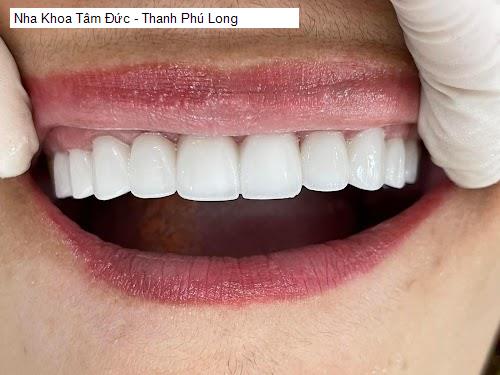 Hình ảnh Nha Khoa Tâm Đức - Thanh Phú Long